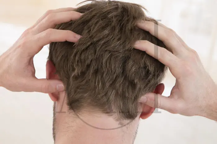 How to Fix Dry Scalp Signs Causes