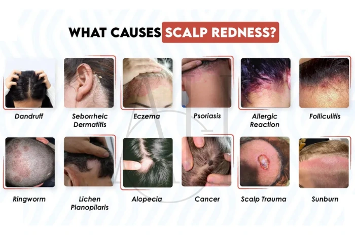 itchy scalp causes hair loss