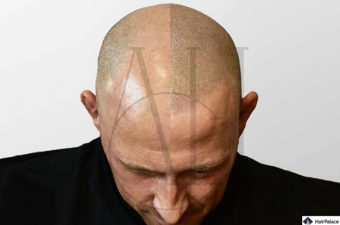 head tattoos for men​