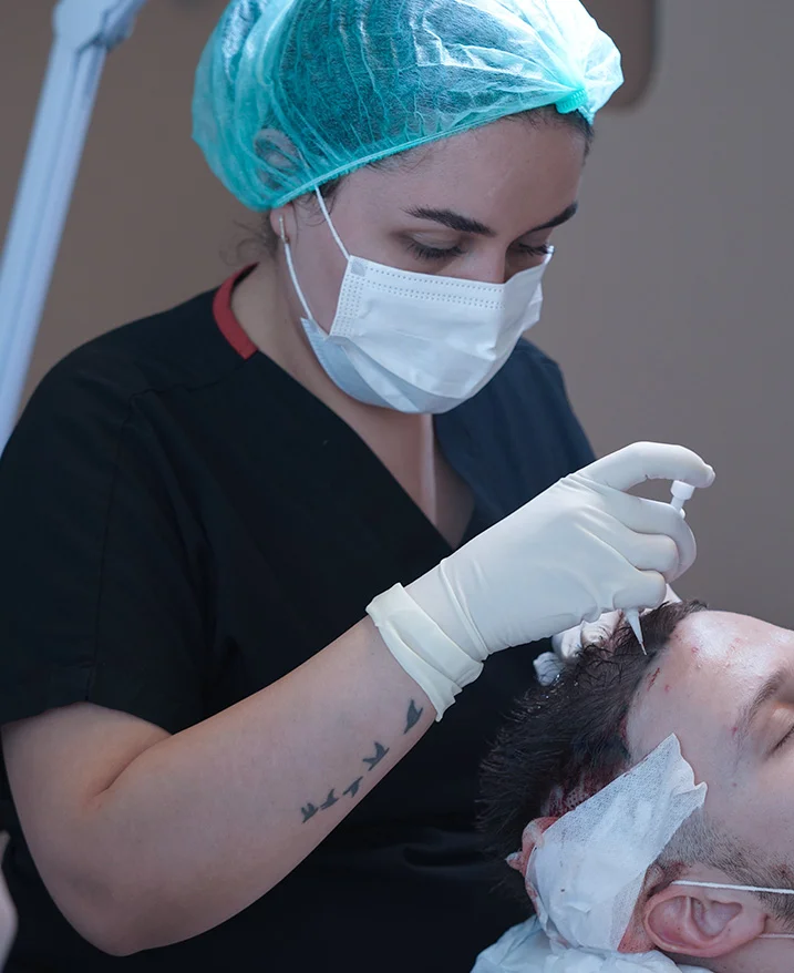 how-hair-transplant-procedure