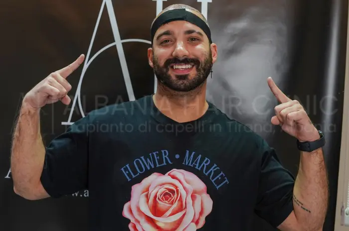 Albania Hair Clinic - Paziente felice