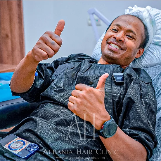 Kryerja e një transplanti flokësh në Shqipëri