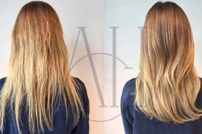 Top-rated hair serums for growth