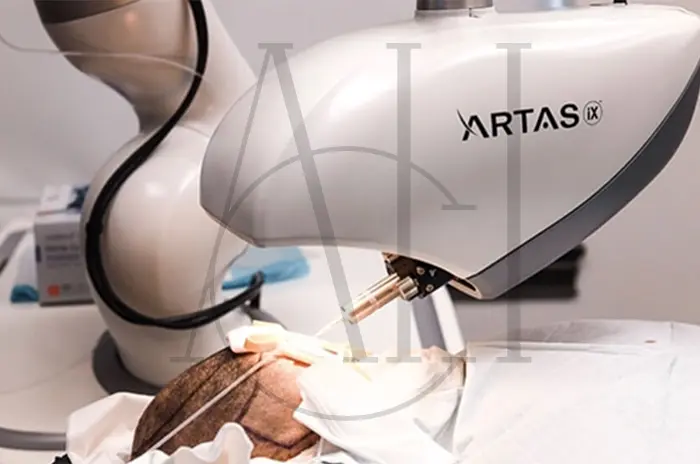 ARTAS Robotic Hair Transplant System (1)