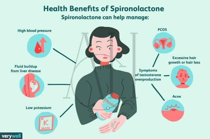 female pattern hair loss