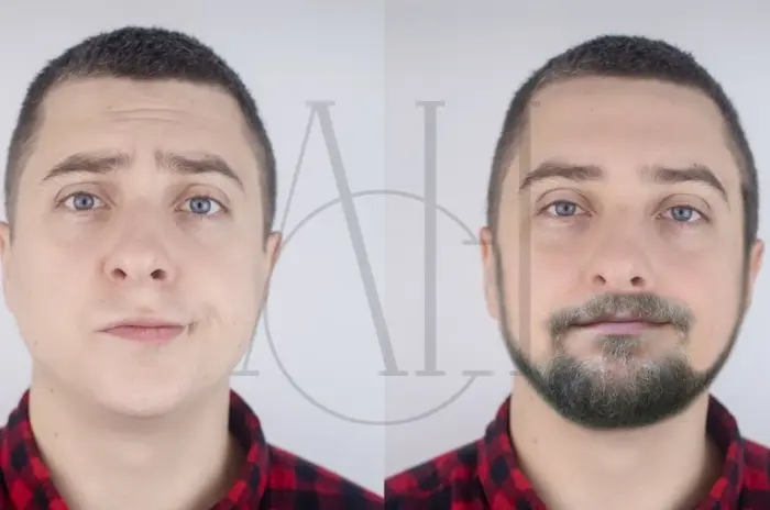 Minoxidil for Beard Growth How It Works and Safety