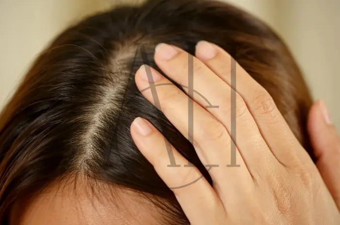 Dry Scalp Medications Remedies and Prevention Tips