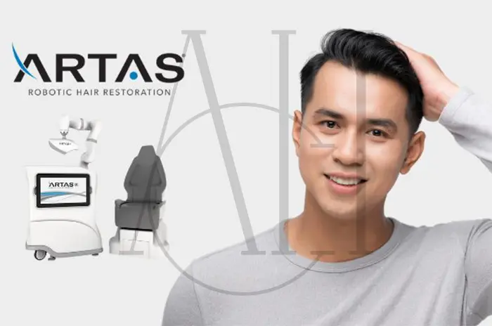 What Is the ARTAS Robotic Hair Transplant System and How It Works