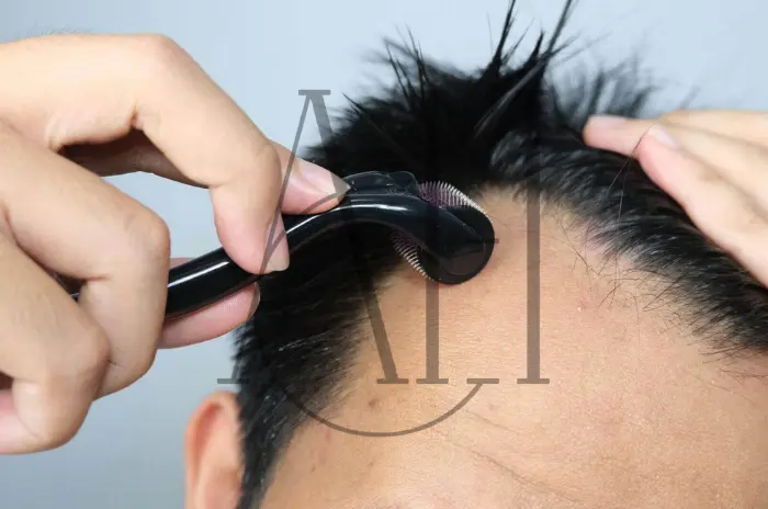 Derma Roller per la Crescita dei Capelli: Recensione degli Esperti