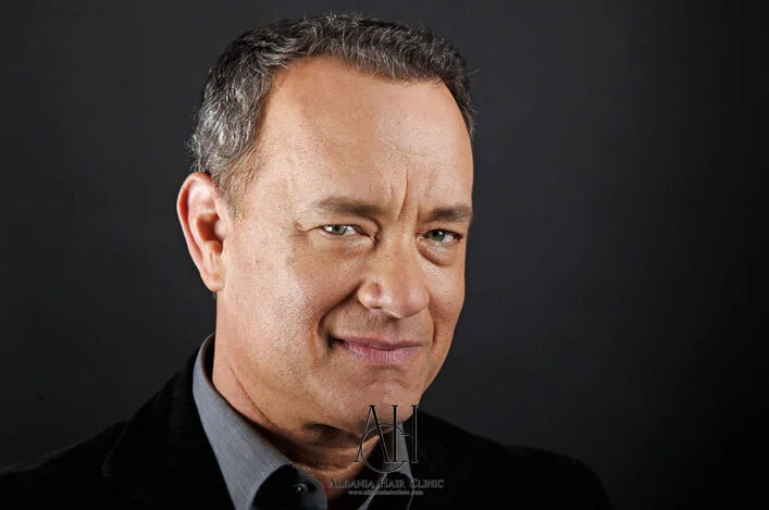 Has Tom Hanks Had a Hair Transplant?