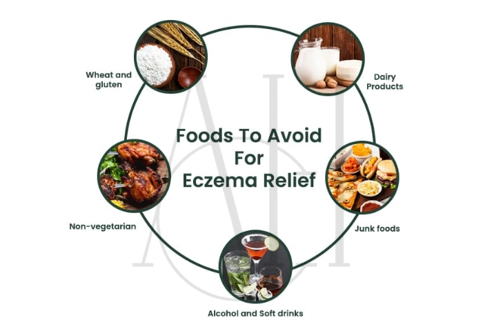 Scalp eczema treatment