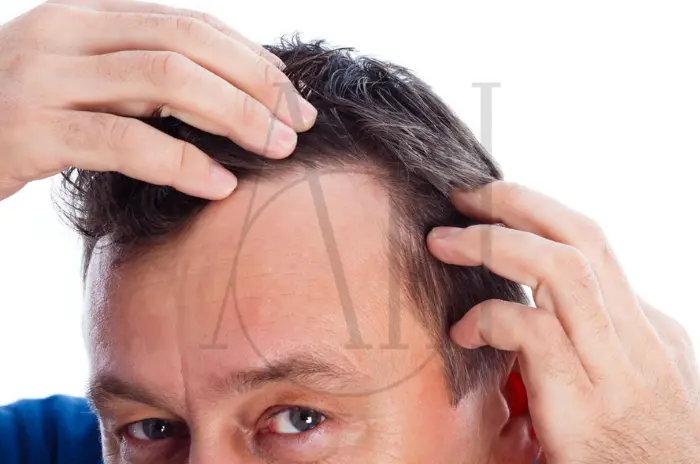 Manage Stress for Better Hair Growth