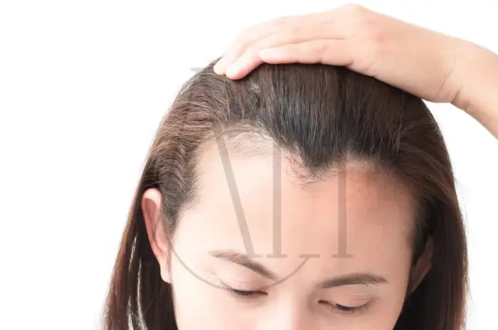 female hairline