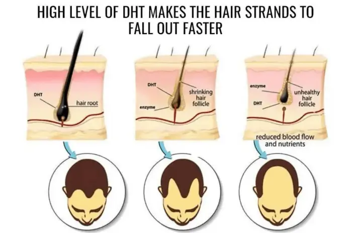 DHT levels in the body