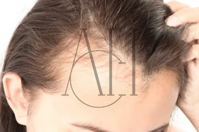 I capelli ricrescono dopo l’alopecia da trazione?