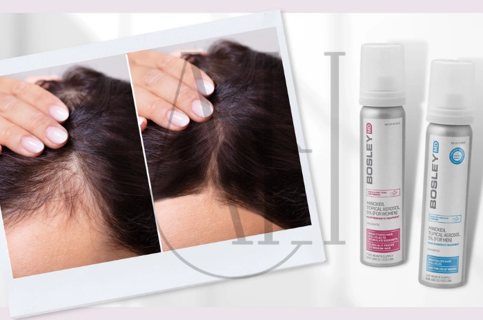 Minoxidil for hair regrowth