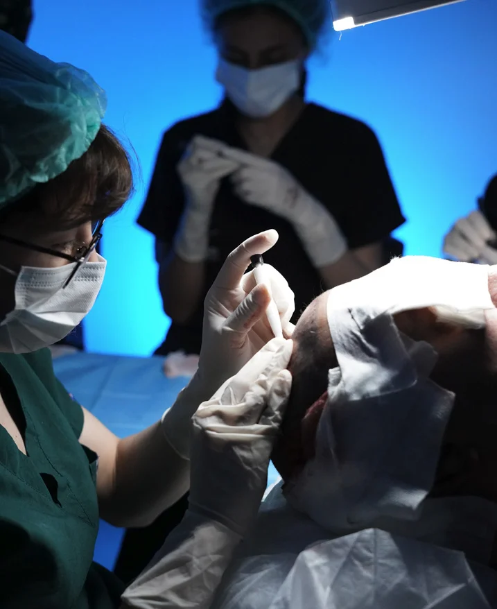 how-many-hair-grafts