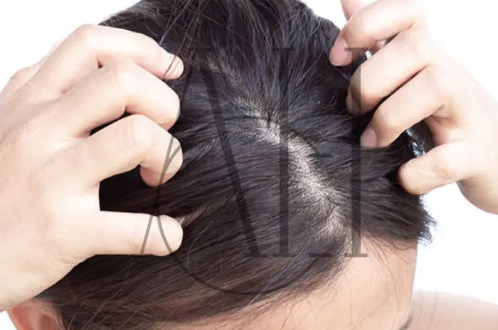 Potential Relationship to Microbiome Regeneration