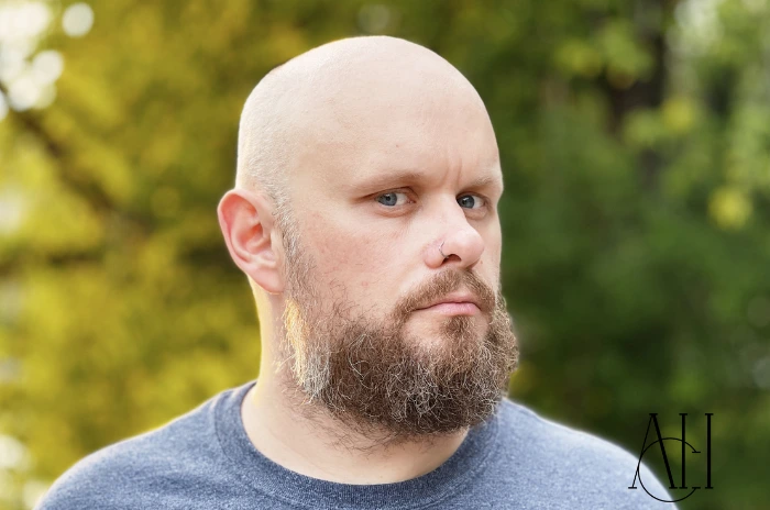 trapianto di barba-albania